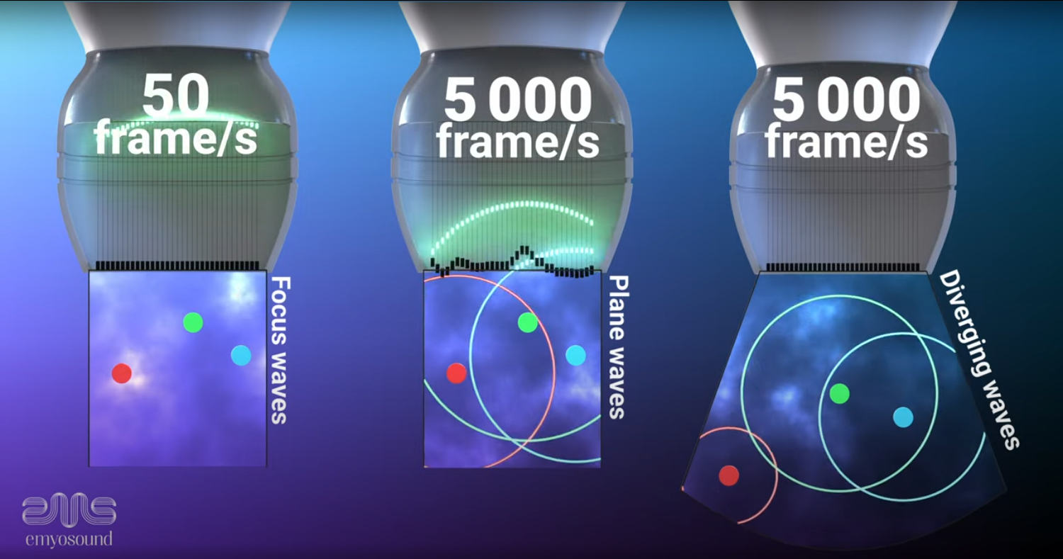 Comparison of focus, plane, and diverging ultrasound waves at 50 to 5,000 fps